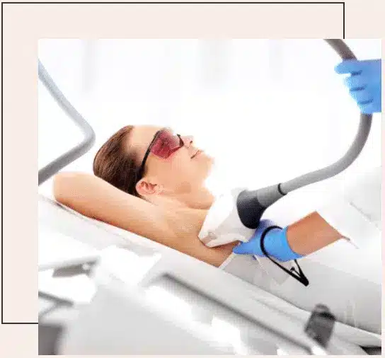 laser-hair-removal-victoria